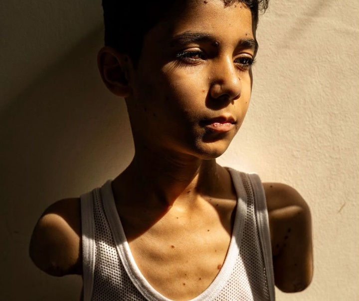Gallery of Photography by Samar Abu Elouf - GAZA