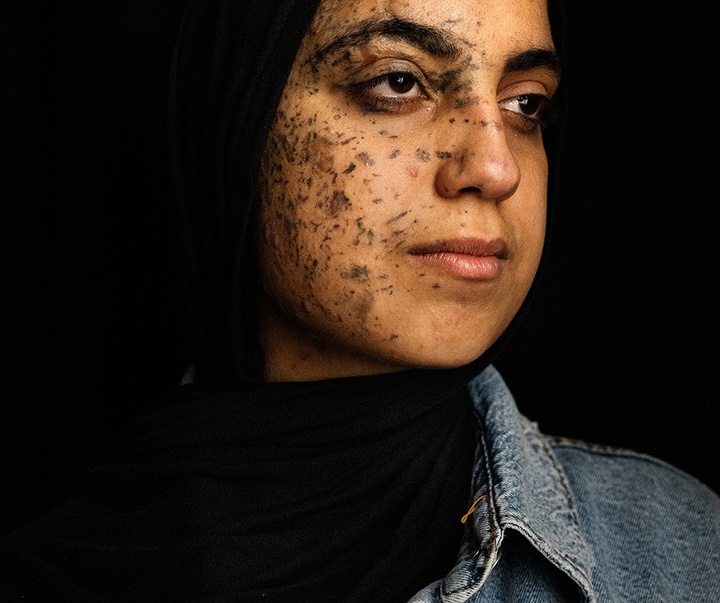 Gallery of Photography by Samar Abu Elouf - GAZA