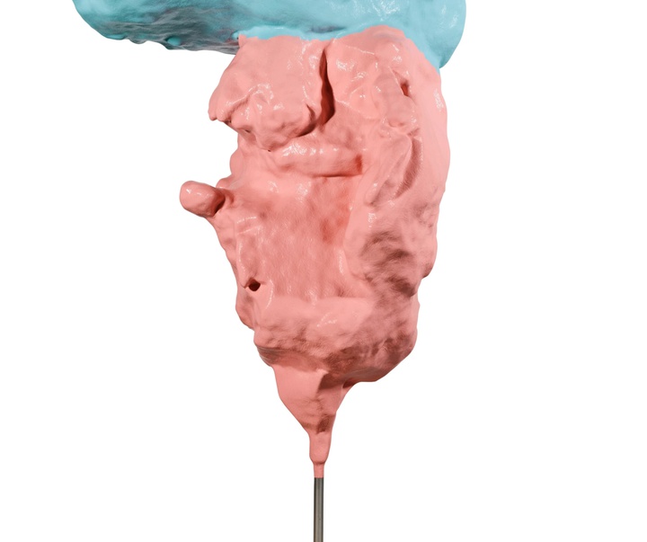 گالری آثار حجم و مجسمه فرانتس وست از اتریش